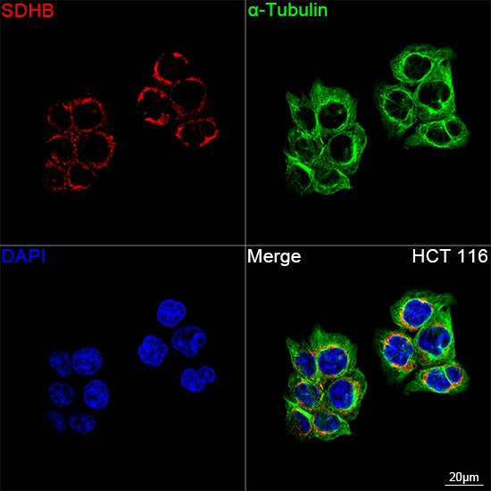 SDHB Antibody in Immunocytochemistry (ICC/IF)