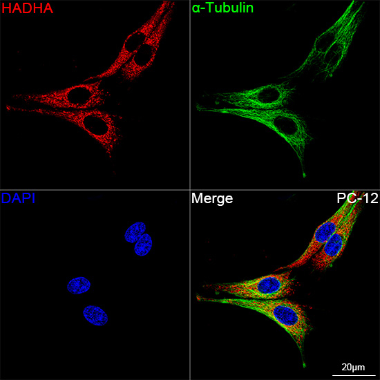 HADHA Antibody in Immunocytochemistry (ICC/IF)