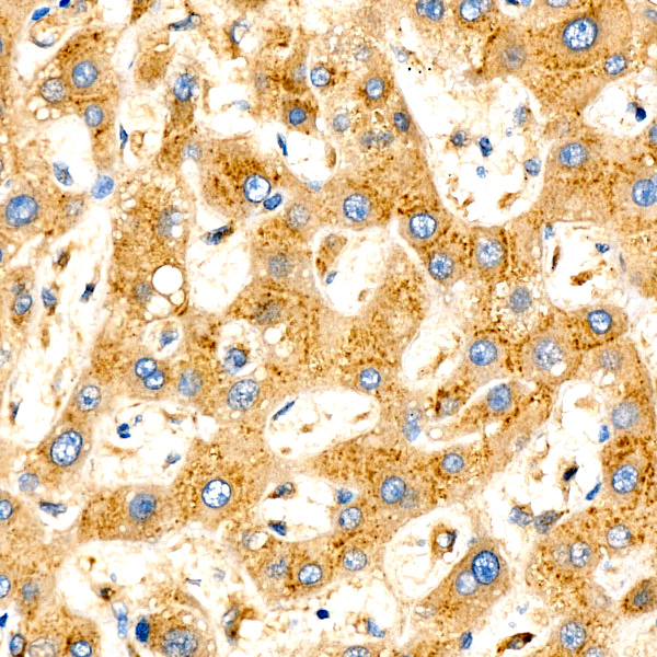 ASM Antibody in Immunohistochemistry (Paraffin) (IHC (P))