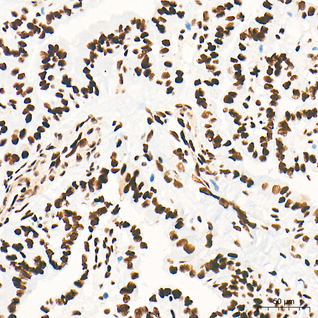 HSF1 Antibody in Immunohistochemistry (Paraffin) (IHC (P))