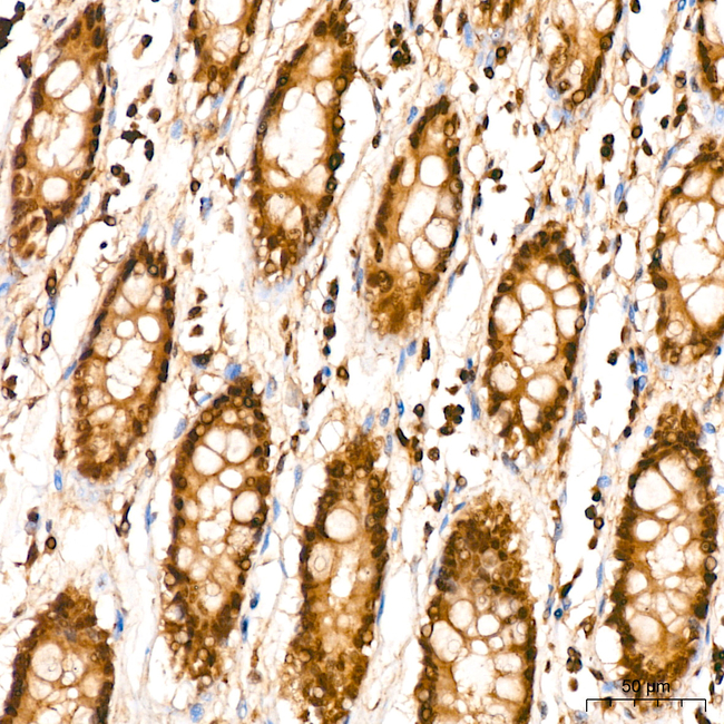 UBE2L6 Antibody in Immunohistochemistry (Paraffin) (IHC (P))