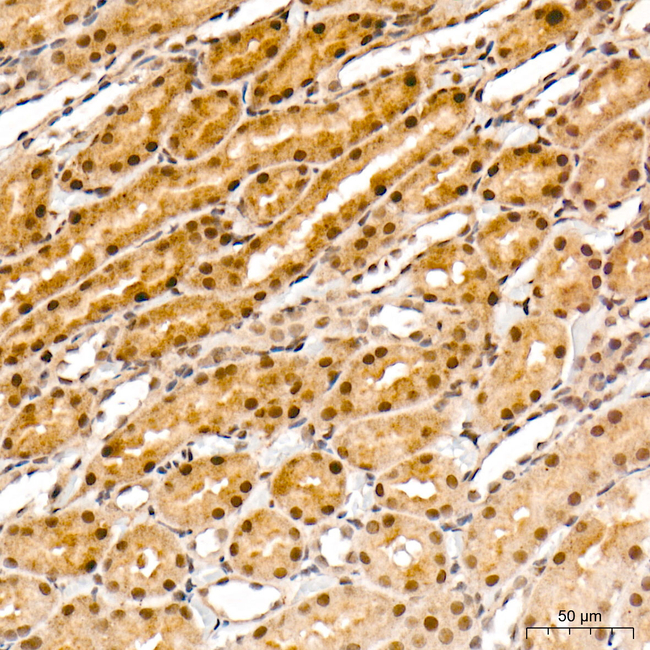 LIMK1 Antibody in Immunohistochemistry (Paraffin) (IHC (P))