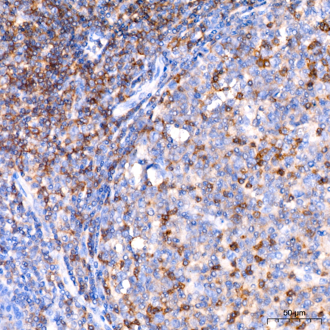 CD11a Antibody in Immunohistochemistry (Paraffin) (IHC (P))