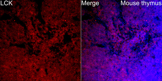 LCK Antibody in Immunohistochemistry (Paraffin) (IHC (P))