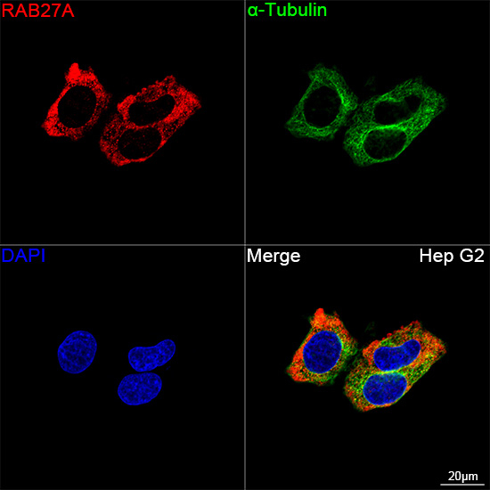 RAB27A Antibody in Immunocytochemistry (ICC/IF)