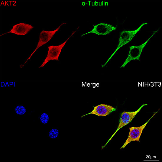 AKT2 Antibody in Immunocytochemistry (ICC/IF)
