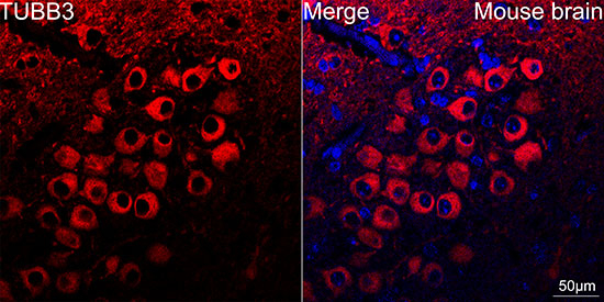 Beta III Tubulin Antibody in Immunohistochemistry (Paraffin) (IHC (P))