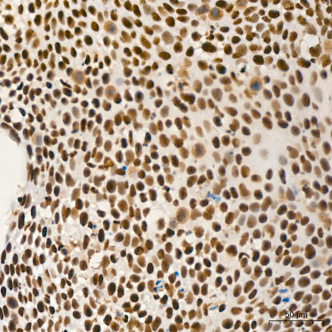 PCIF1 Antibody in Immunohistochemistry (Paraffin) (IHC (P))