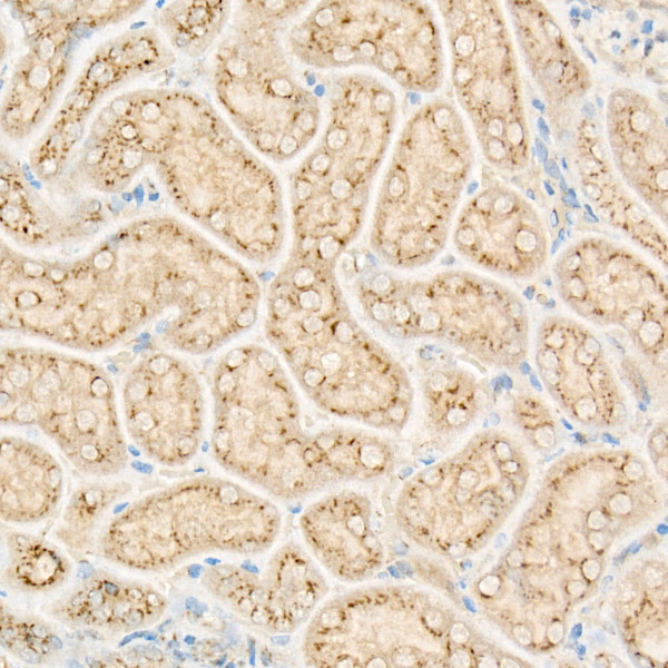 FAM3A Antibody in Immunohistochemistry (Paraffin) (IHC (P))