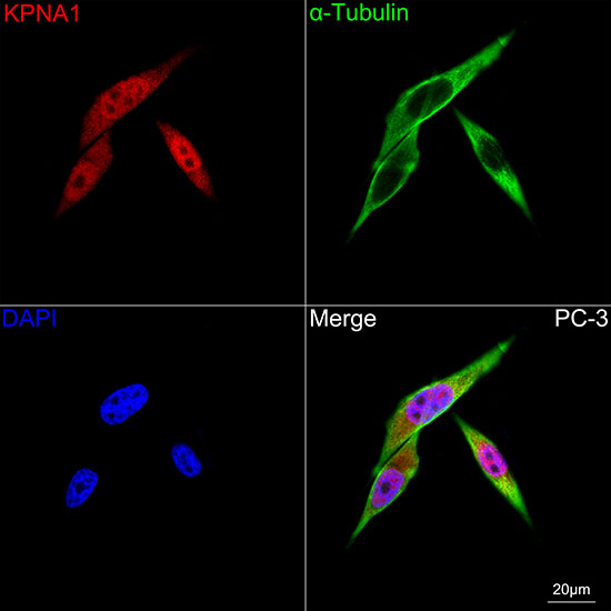 KPNA1 Antibody in Immunocytochemistry (ICC/IF)