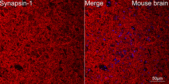 Synapsin 1 Antibody in Immunohistochemistry (Paraffin) (IHC (P))
