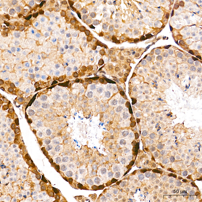 Mgea5 Antibody in Immunohistochemistry (Paraffin) (IHC (P))