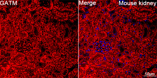 GATM Antibody in Immunohistochemistry (Paraffin) (IHC (P))