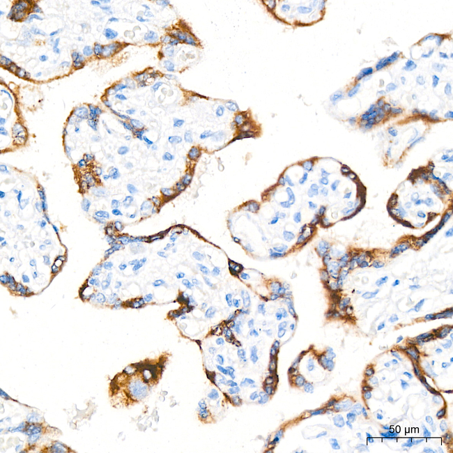 hCG beta Antibody in Immunohistochemistry (Paraffin) (IHC (P))