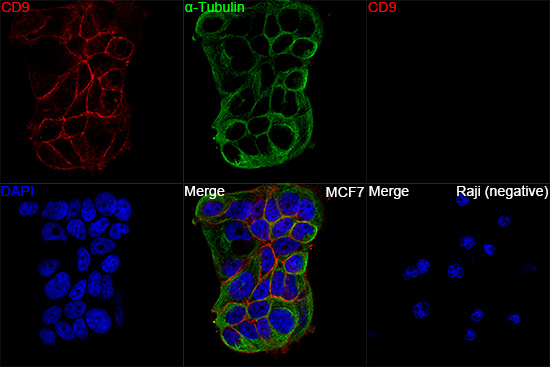CD9 Antibody in Immunocytochemistry (ICC/IF)