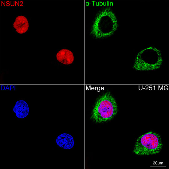 NSUN2 Antibody in Immunocytochemistry (ICC/IF)