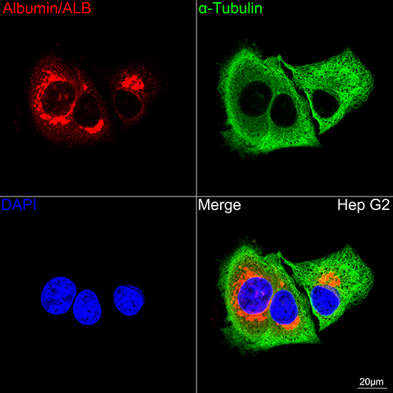 Albumin Antibody in Immunocytochemistry (ICC/IF)
