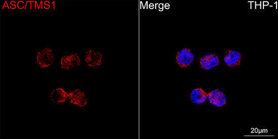 PYCARD Antibody in Immunocytochemistry (ICC/IF)