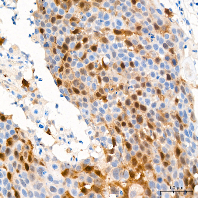 Thymidylate Synthase Antibody in Immunohistochemistry (Paraffin) (IHC (P))