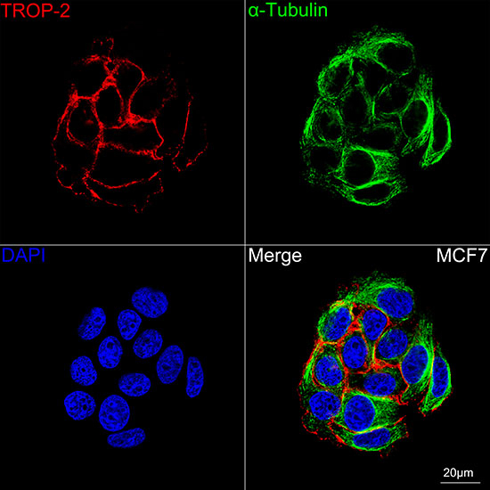 TROP2 Antibody in Immunocytochemistry (ICC/IF)