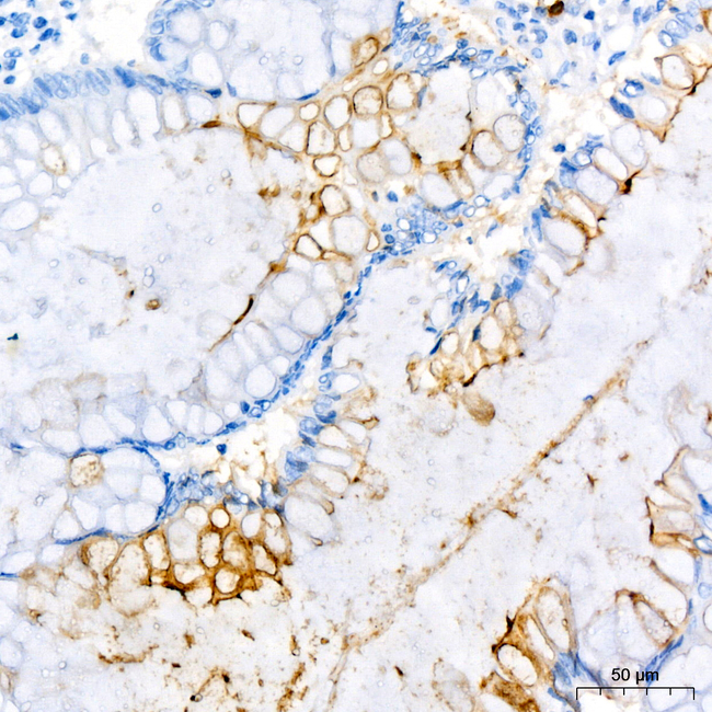 CD177 Antibody in Immunohistochemistry (Paraffin) (IHC (P))