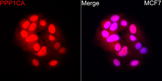 PP1 alpha Antibody in Immunocytochemistry (ICC/IF)