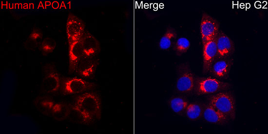 ApoA1 Antibody in Immunocytochemistry (ICC/IF)