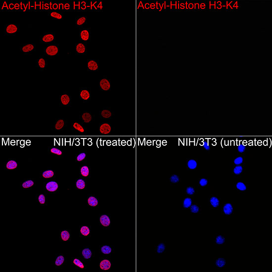 H3K4ac Antibody in Immunocytochemistry (ICC/IF)