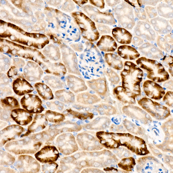 MEK1/MEK2 Antibody in Immunohistochemistry (Paraffin) (IHC (P))