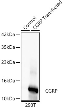 CGRP Antibody in Western Blot (WB)