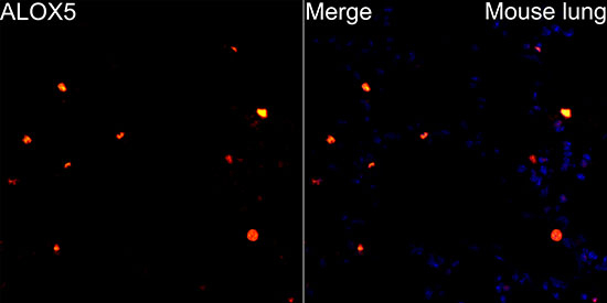 ALOX5 Antibody in Immunohistochemistry (Paraffin) (IHC (P))