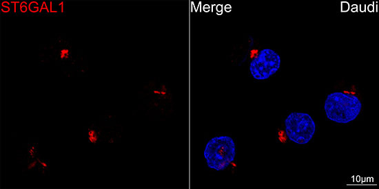 CD75 Antibody in Immunocytochemistry (ICC/IF)