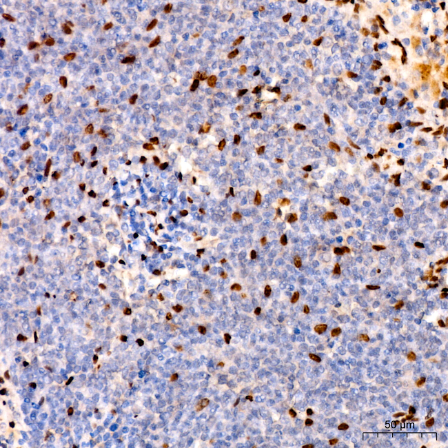 NR2F2 Antibody in Immunohistochemistry (Paraffin) (IHC (P))