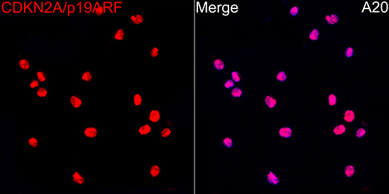 p19ARF Antibody in Immunocytochemistry (ICC/IF)