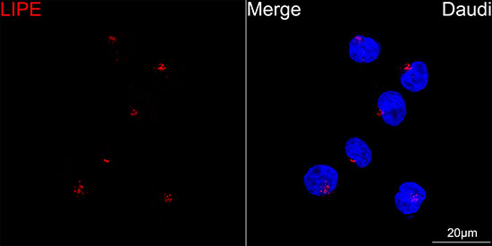 HSL Antibody in Immunocytochemistry (ICC/IF)