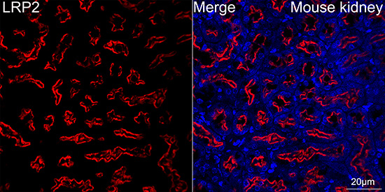 LRP2 Antibody in Immunocytochemistry (ICC/IF)