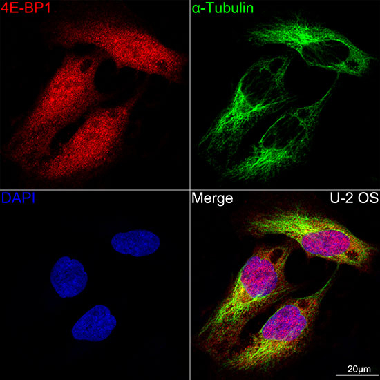 4EBP1 Antibody in Immunocytochemistry (ICC/IF)
