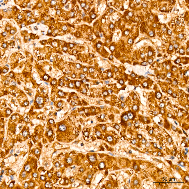 PPAP2B Antibody in Immunohistochemistry (Paraffin) (IHC (P))