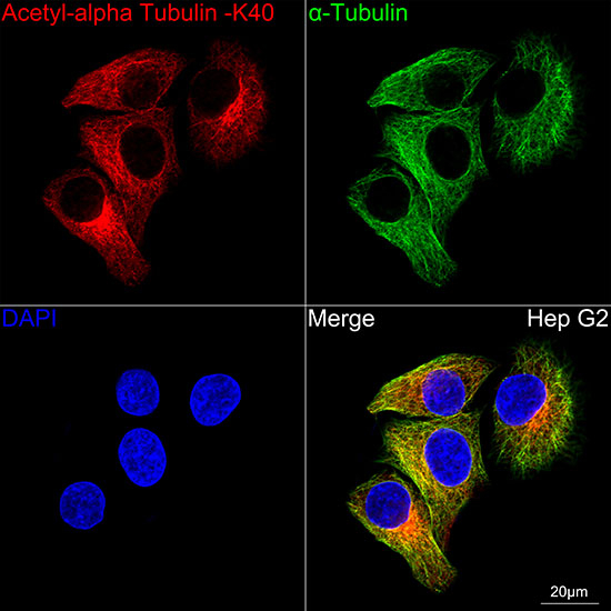 Acetyl-alpha Tubulin (Lys40) Antibody in Immunocytochemistry (ICC/IF)