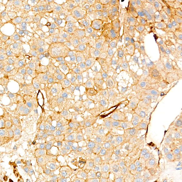 UBE2C Antibody in Immunohistochemistry (Paraffin) (IHC (P))