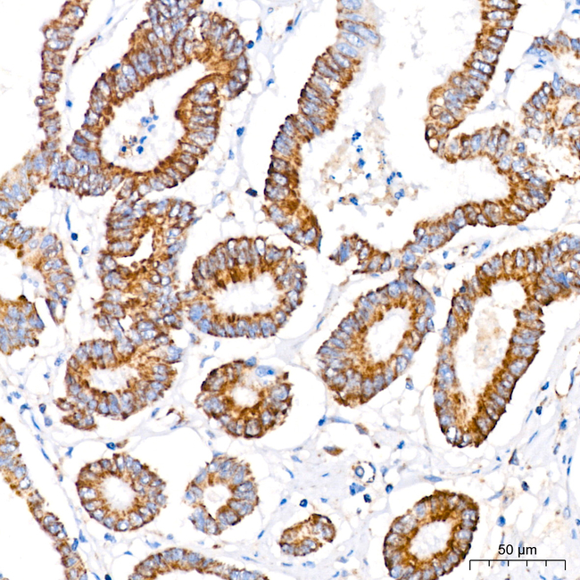 MTCO1 Antibody in Immunohistochemistry (Paraffin) (IHC (P))