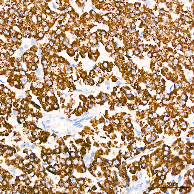CPS1 Antibody in Immunohistochemistry (Paraffin) (IHC (P))