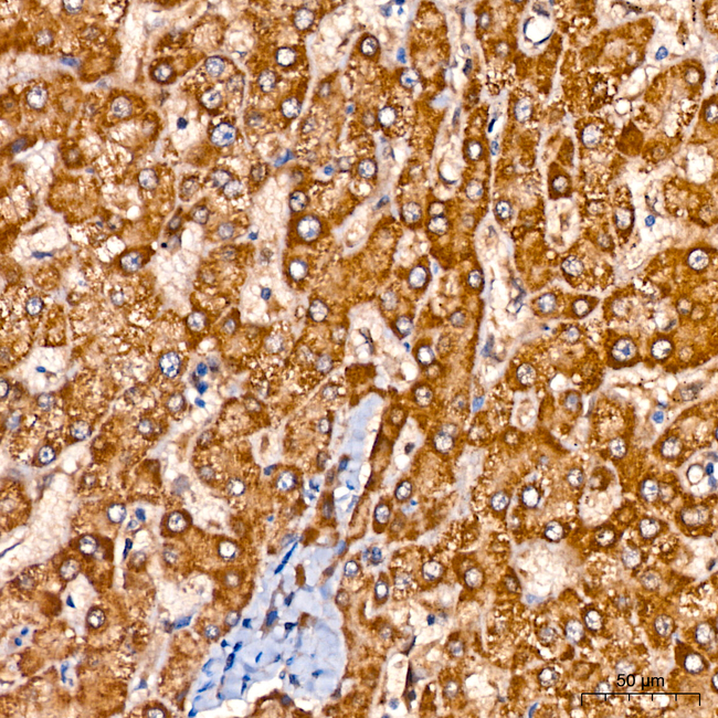 GLYAT Antibody in Immunohistochemistry (Paraffin) (IHC (P))