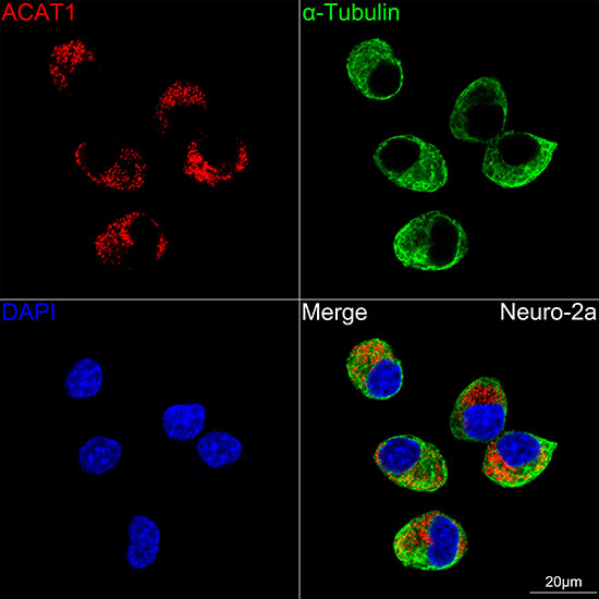 ACAT1 Antibody in Immunocytochemistry (ICC/IF)