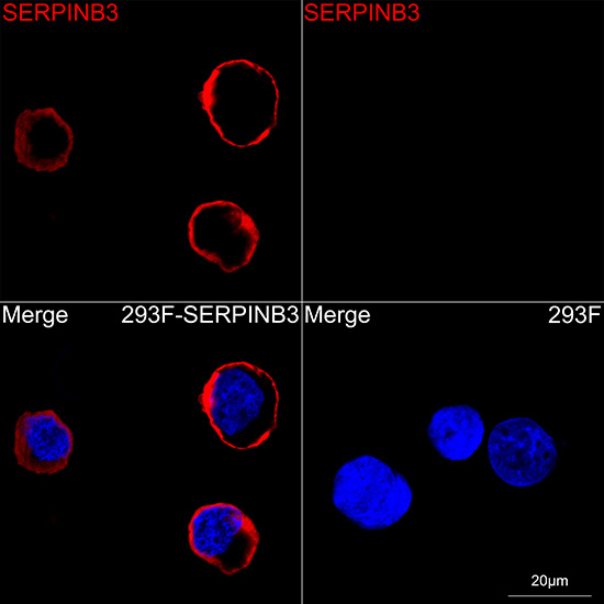 SERPINB3 Antibody in Immunocytochemistry (ICC/IF)