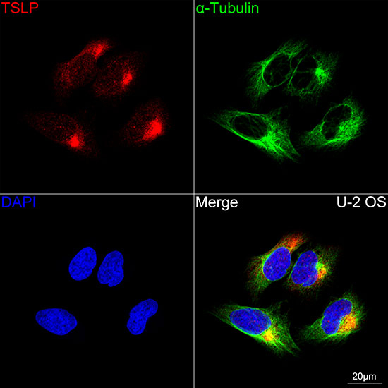 TSLP Antibody in Immunocytochemistry (ICC/IF)