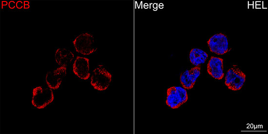 PCCB Antibody in Immunocytochemistry (ICC/IF)