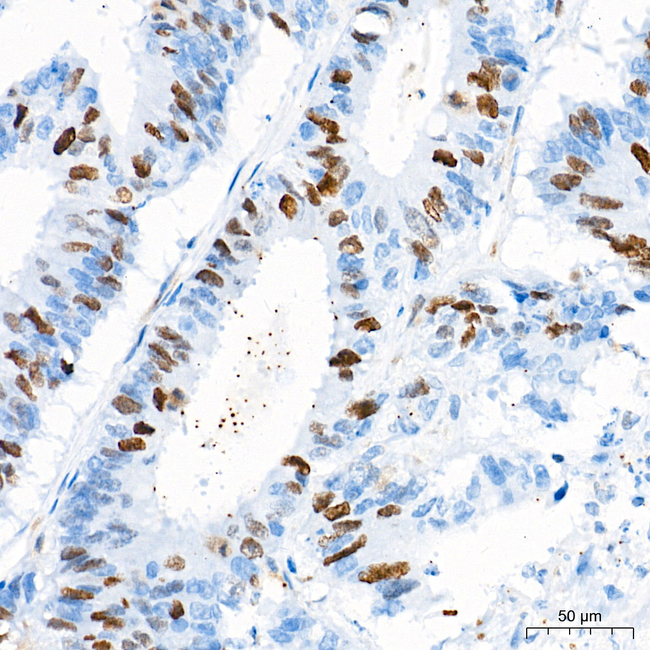 RACGAP1 Antibody in Immunohistochemistry (Paraffin) (IHC (P))