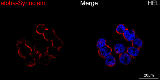 alpha Synuclein Antibody in Immunocytochemistry (ICC/IF)