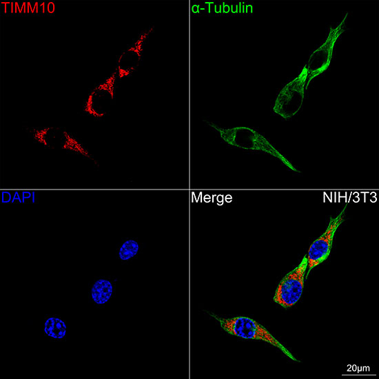 TIMM10 Antibody in Immunocytochemistry (ICC/IF)